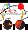 Stimulated Raman scattering (SRS) imaging of glucose uptake activity by targeting the alkyne tag of a novel glucose analogue in live mouse brain hippocampal neurons and tumor tissues (in red).