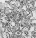 This is a transmission electron micrograph (TEM) of Zika virus.