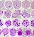 Red blood cell stages of <i>Plasmodium vivax</i> from malaria patients in Thailand.
