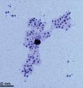 Transmission electron microscopy (TEM) image of silver nanoparticles formed from silver ions in solution with humic acid. The acid tends to coat the nano particles (visible here as a pale cloud), keeping them in a colloidal suspension instead of clumping Transmission electron microscopy (TEM) image of silver nanoparticles formed from silver ions in solution with humic acid. The acid tends to coat the nano particles (visible here as a pale cloud), keeping them in a colloidal suspension instead of clumping